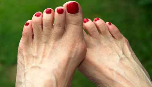 Сохраняем легкость походки: подагра на ноге большого пальца