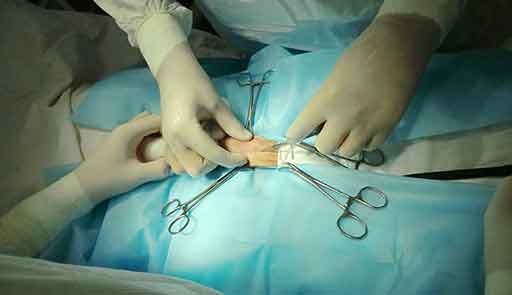 операция на детородном органе
