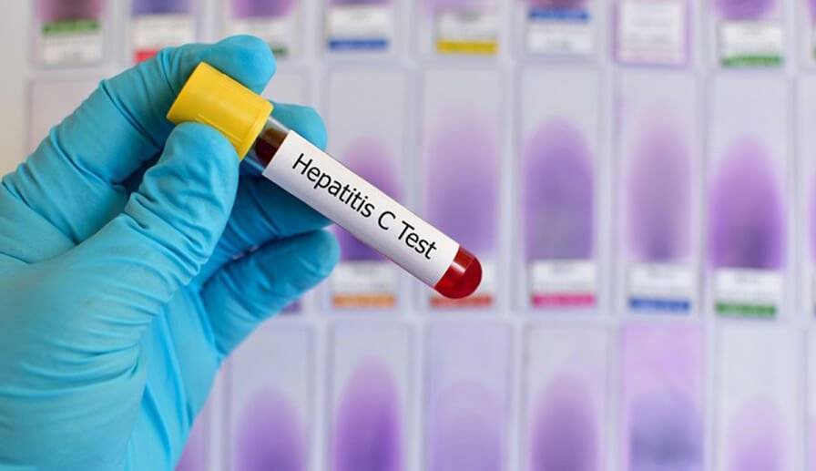 тест на гепатит